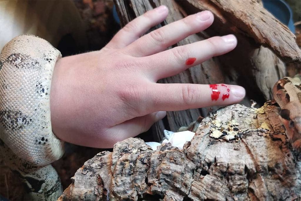 child's hand bitten by a boa